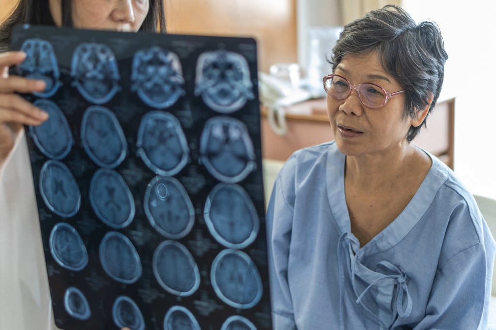 medical doctor showing elderly woman images of brain scans