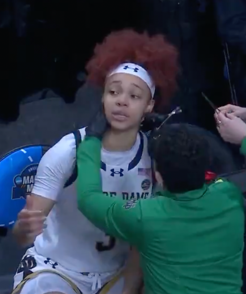 Notre Dame's Hannah Hidalgo had to get a nose ring removed during the second quarter against Oregon State. 