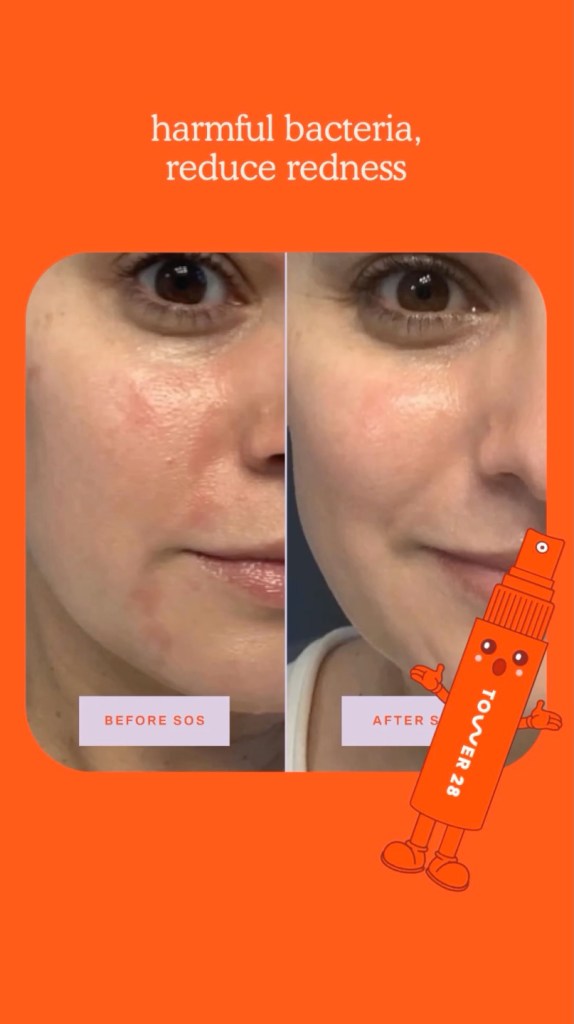 Hypocholorous acid is "helpful for those dealing with breakouts, and the spray formulation makes it a great option for post-workout," Garshick shared.