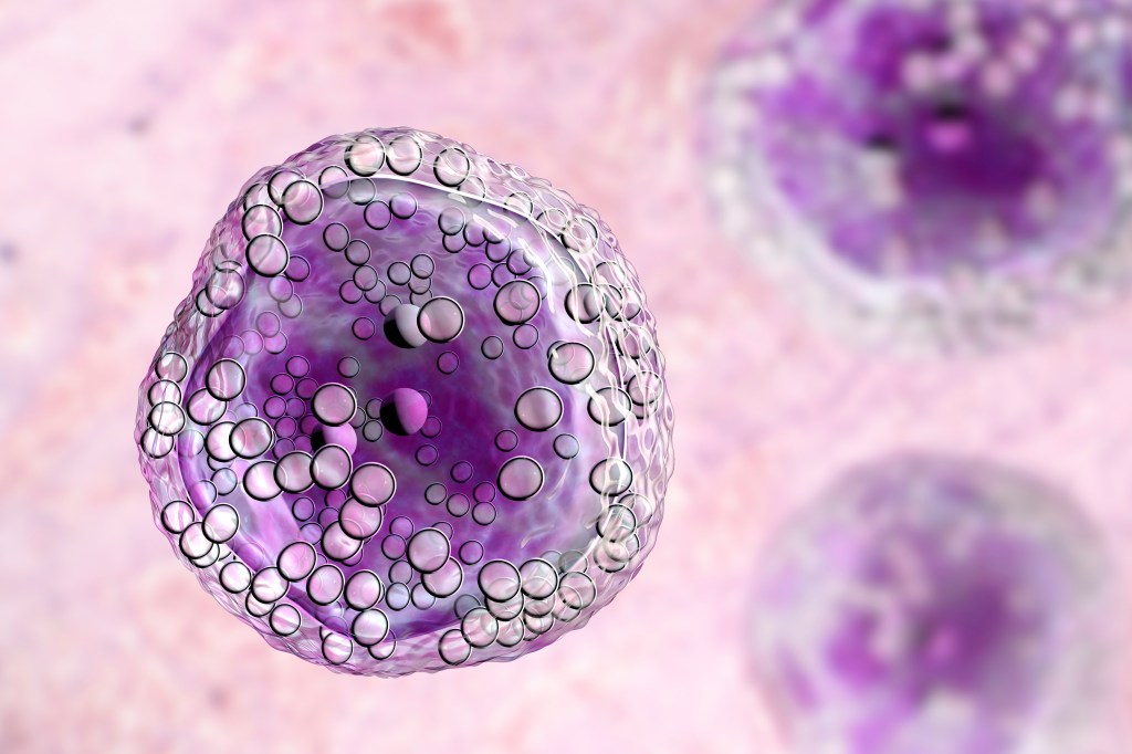 These are cells of Burkitt lymphoma, one of the cancers researched in this new study.