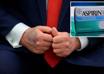Could too much aspirin be responsible for Trump's hand bruising