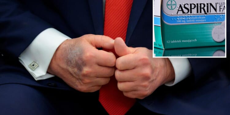 Could too much aspirin be responsible for Trump's hand bruising