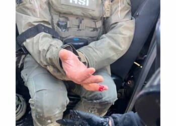 Rioter in Minneapolis Bites Off Finger of HSI Officer – Twitchy