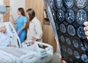 Alzheimer's symptoms could be predicted years in advance through one simple test