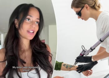 Influencer reveals 'disgusting' complication of tattoo removal