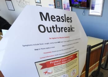 CDC staffers deployed to South Carolina to aid measles response