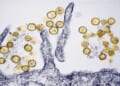 Hantavirus: Where the rare, sometimes deadly disease has been found in the US